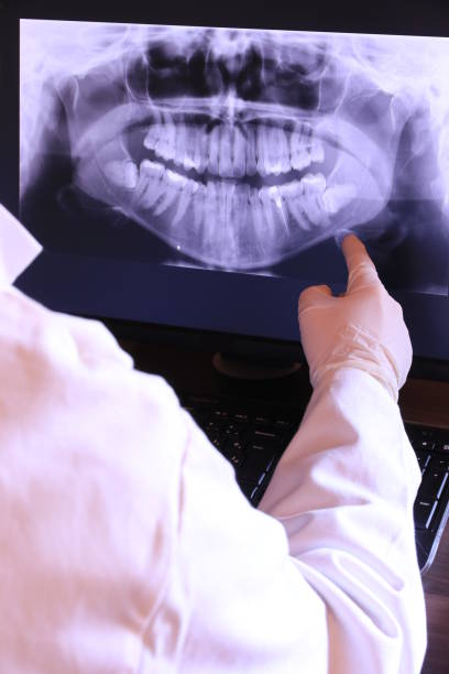 Best Emergency Wisdom Teeth Removal in Erie, IL