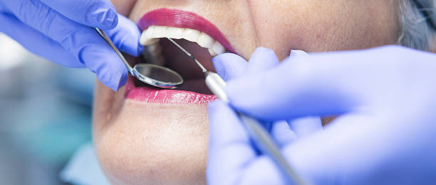 Best Emergency Treatment for Dental Infections or Abscesses in Erie, IL